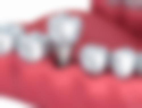 潍坊高新寨子口腔医生简介