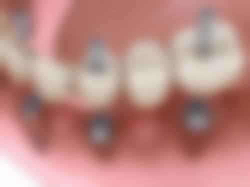 广东佛山润博口腔怎么样？资质如何？