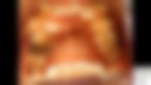 焦国良医生口碑如何