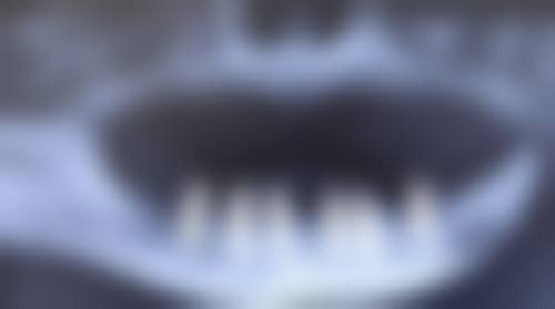 广东中山海豚口腔正规吗