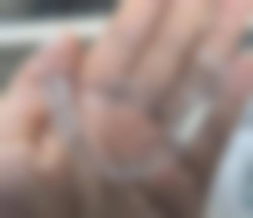 浙江金华詹娟口腔诊所可靠吗