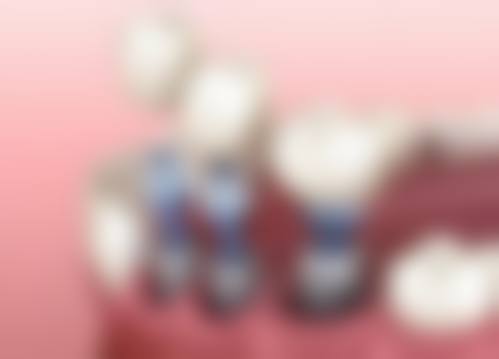 武汉郎歌口腔门诊部顾客实例
