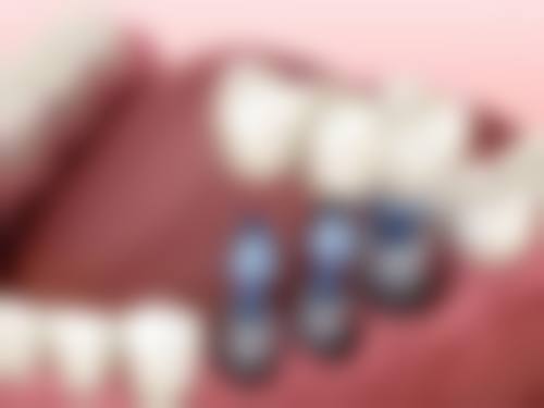 重庆梁平陶镛口腔医生情况