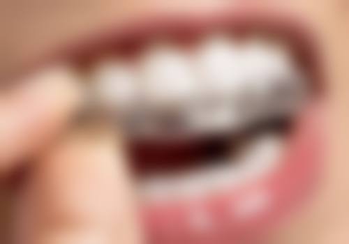 沈阳爱齿口腔门诊部顾客实例