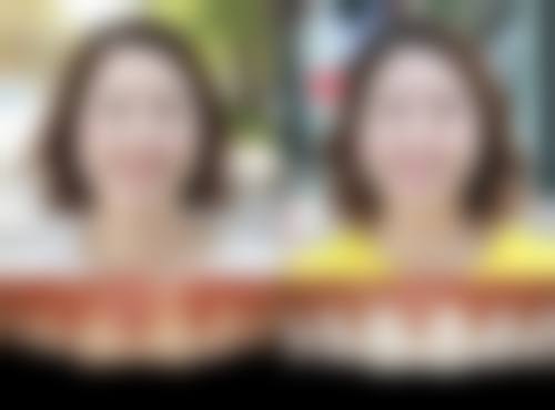 威海李莉口腔抖音团购活动及价格表