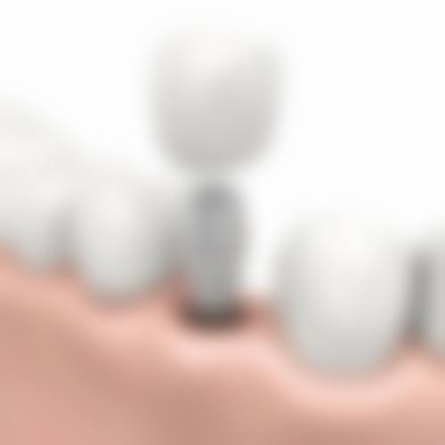 宿州市哪家口腔医院较便宜——宿州西苑医院口腔科