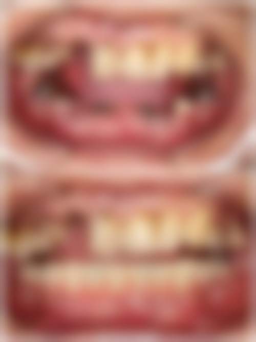 福州连江县胡明辉口腔口碑好不好
