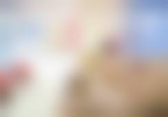 眼综合必看！苏州美贝尔美容医院胡瑞做过的真实反馈汇总：技术口碑如何？5点术后护理建议必读！