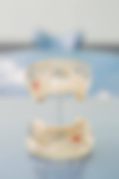 优惠活动详情:限时特别优惠,预约从速