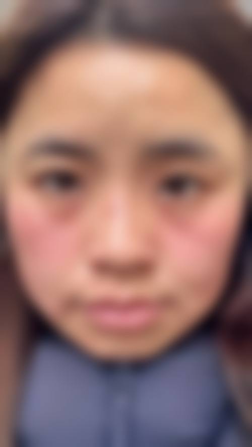 擅长项目详解:徐正一,天津缪慈医疗美容门诊部