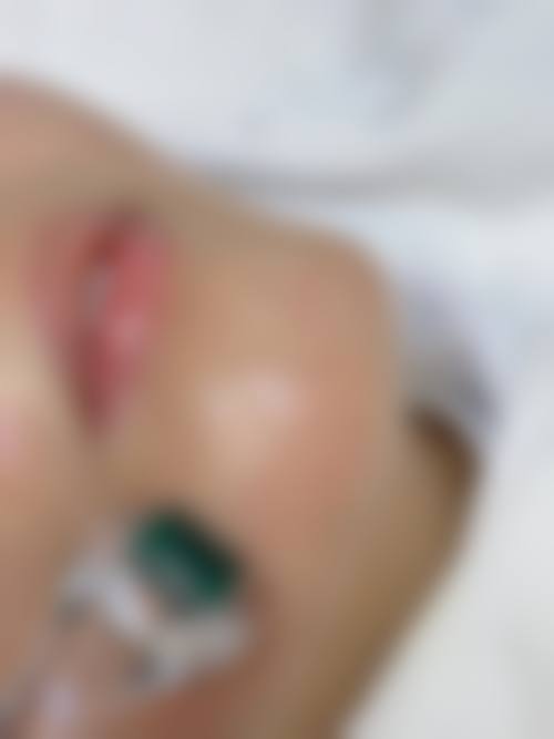 诊疗特色总结:徐正一,天津缪慈医疗美容门诊部