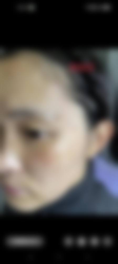 临床实例分享：郭爱萍医生的成功实践