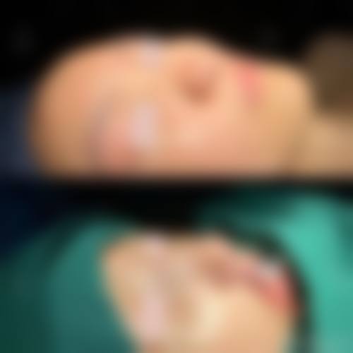 预约优惠活动：郭爱萍医生的专属补贴