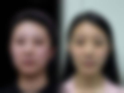 优惠活动详情