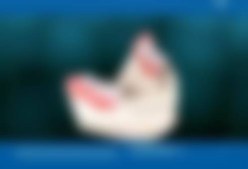 预约优惠活动