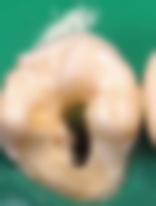 专属优惠活动详情