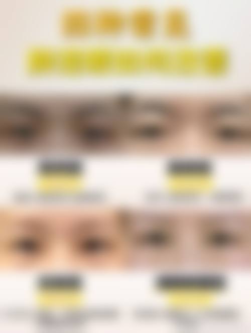 总结与预约号召