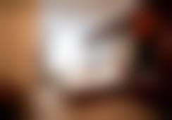 苏州美贝尔美容医院宋茂芹靠谱吗？看这3个真实案例你就知道！价格透明技术可靠
