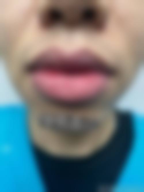 医院资质与实力:正规性与专精保护