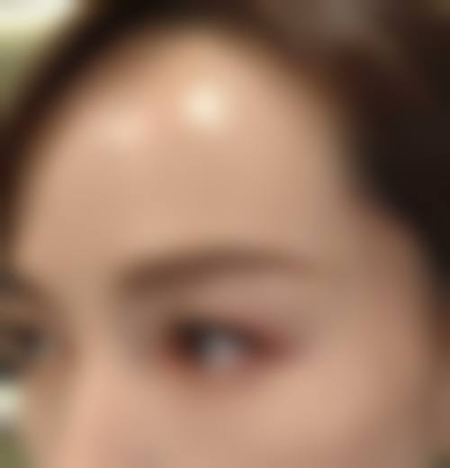 特色项目与技术:无痕植发,成效自然