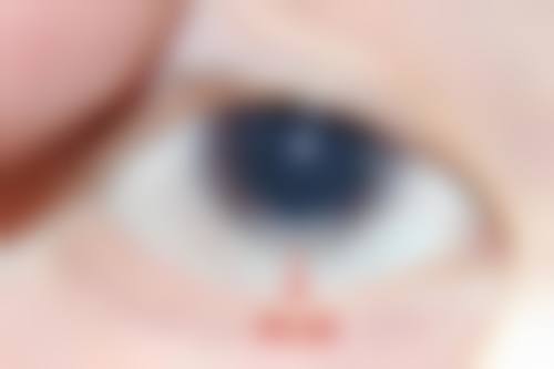 3. 深圳友华普惠眼科擅长项目:覆盖全年龄段眼健康需求
