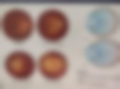 2. 深圳友华普惠眼科怎么样?正规吗?