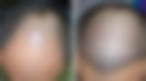 天津黛颜整形医院擅长哪些项目?