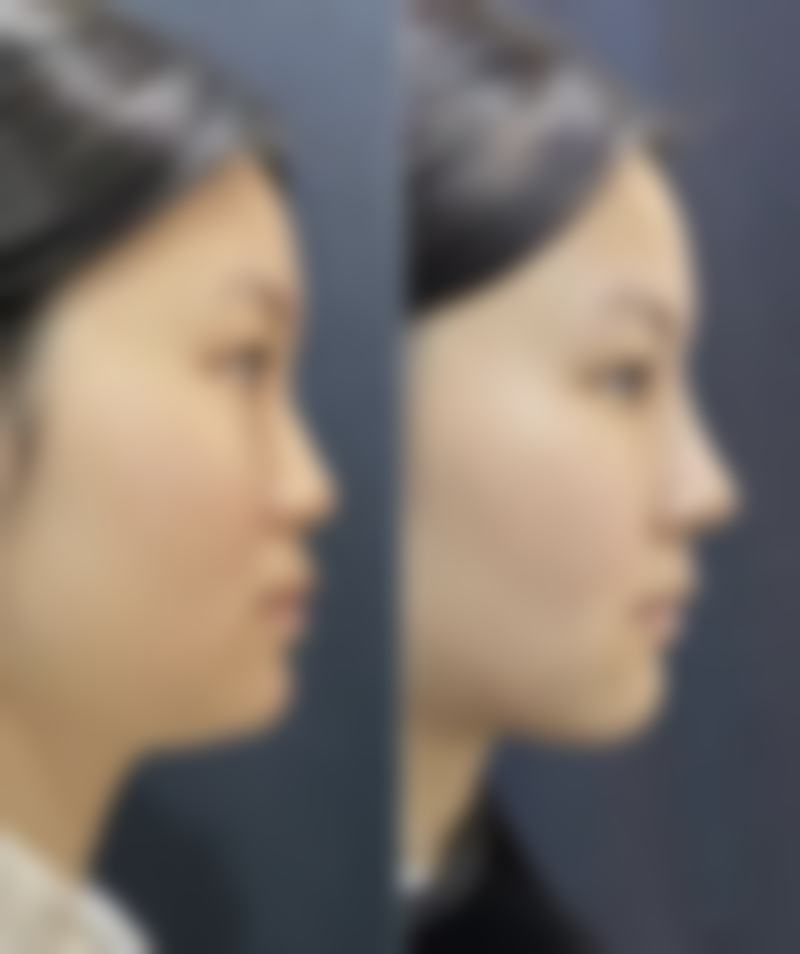 天津黛颜整形医院口碑如何?听听她们的真实评价