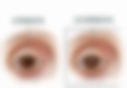 大石桥市中 心医院眼科口碑好不好？患者真实评价如何？