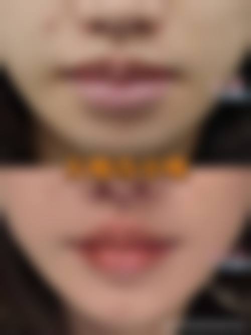 广州达琳思医疗美容门诊部唐聪医生擅长项目有哪些？