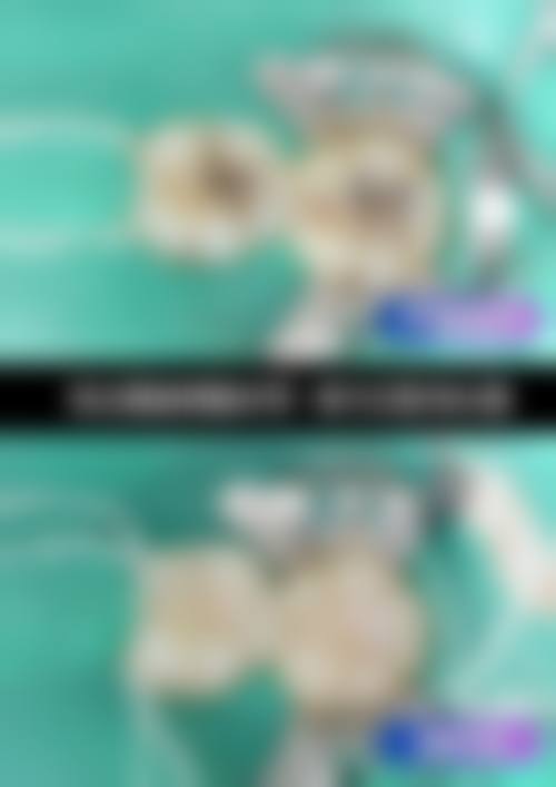 快问快答:关于刘梦晴医生,这些你可能也想了解