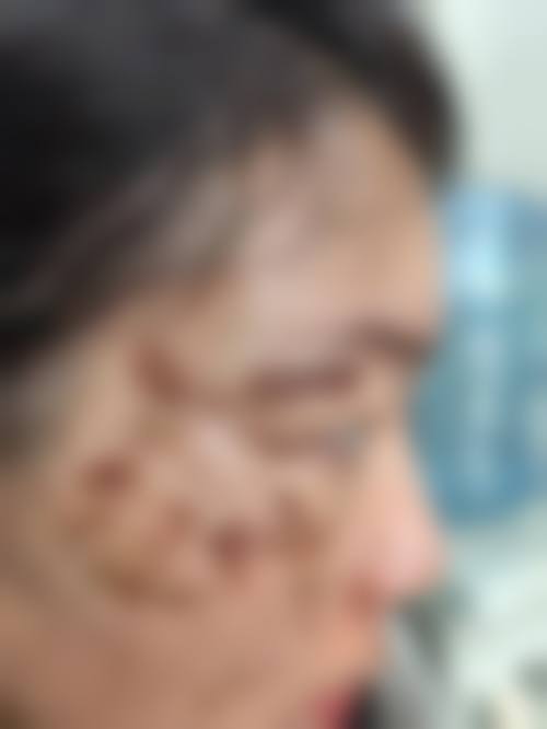 优惠活动详情