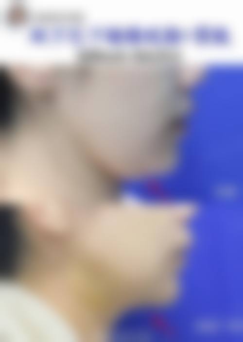 日照岚山区妇幼保健站整形科的擅长项目——从面部到形体的综合改善