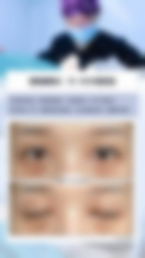 优惠活动与价格参考