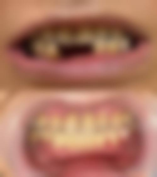 优惠活动与价格详情:透明收费,实惠看牙