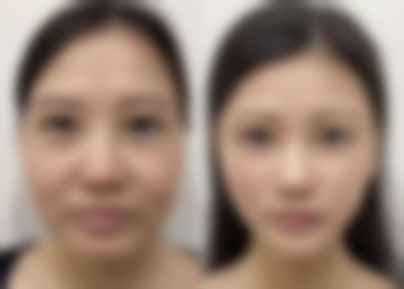 通化宸之辉医疗美容诊所的技术优势与医生团队